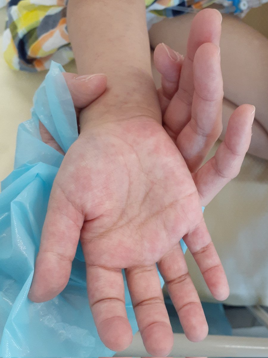 娘は、0歳と4歳の時にPICUのお世話になりました。
産まれた時はNICUでした。
保険診療の自己負担分が助成されなければ、必要な治療を受けさせてあげることはできなかったでしょう。
少なくとも総額6000万円以上の医療費がかかっています。
申し訳ございません。
そして、ありがとうございます。