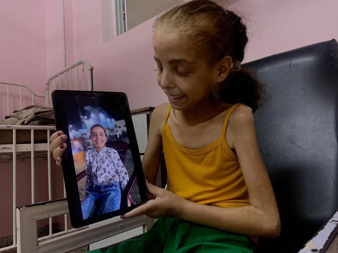 "I used to have a body like this...
But hunger destroyed me, devoured my flesh, and took away my strength.

A Child from Gaza telling his story
