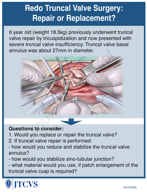 Reoperation for truncal valve repair is always easier than initial repair in neonatal period. There are many  options to achieve durable repair. Read: Konstantinov IE. Redo truncal valve surgery: Repair or replacement? JTCVS 2025 
doi: 10.1016/j.jtcvs.2025.07.002. PMID: 40651769