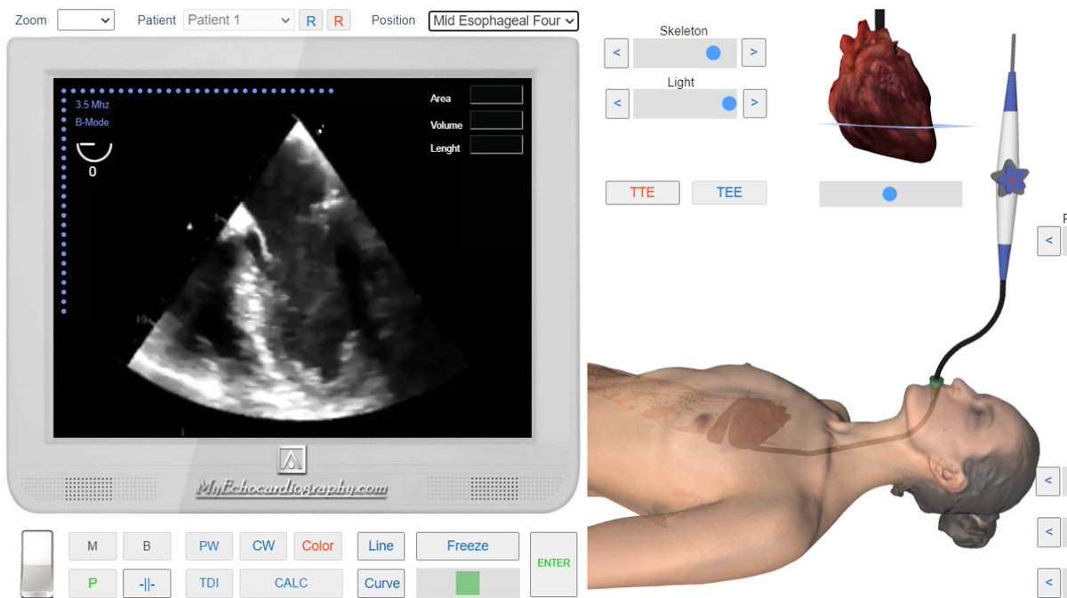 Transesophageal Echocardiography Simulator. myechocardiography.com