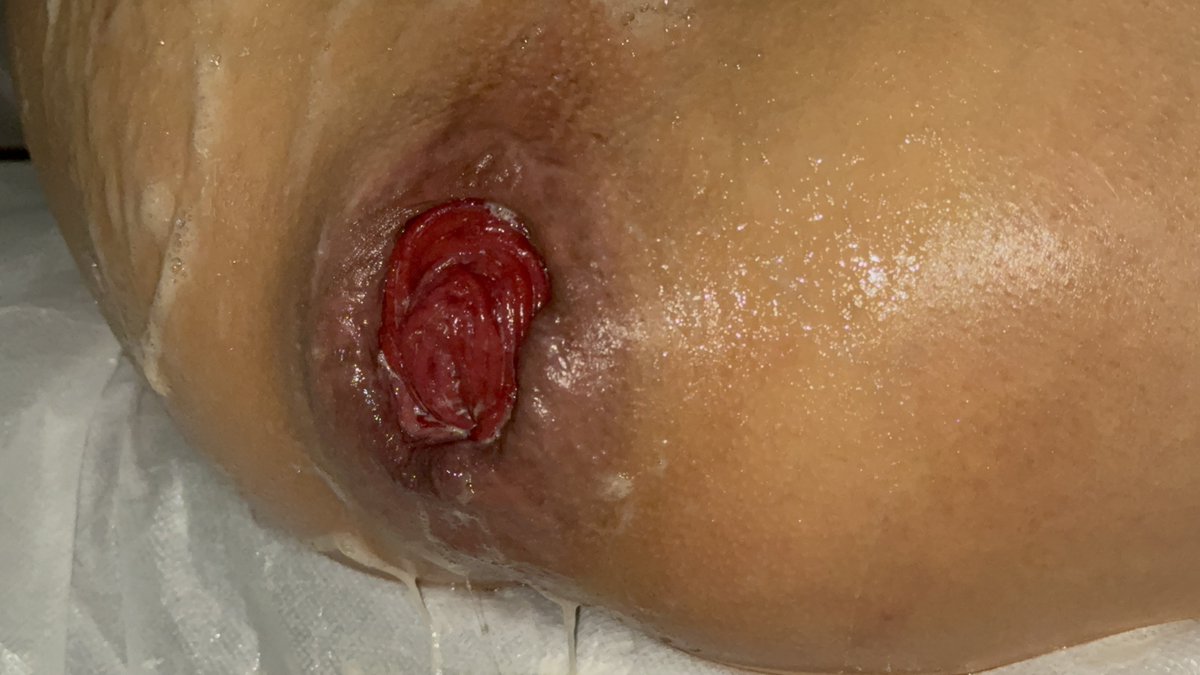 一波大玫瑰预告
punch 1000 拳
#拳交 #拳攻 #拳奴 #拳M #拳头S #圣水 #fisting 
🌹 ：<a href="/Leon12559999/">Leon</a>