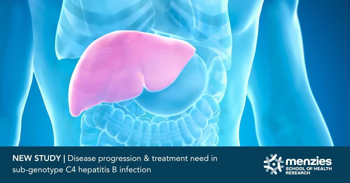 NEW STUDY | Researchers have led the largest-ever study of people living with a unique strain of chronic hepatitis B (C4 Hep B), uncovering significant impacts on liver health. Learn more about these findings and the work of the Hep B PAST Plus program: menzies.edu.au/page/News_and_…