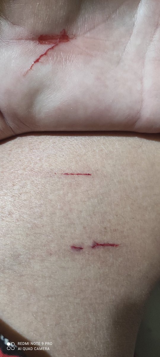 sali a darle comida a los gatos sin karen q viven en el pueblo y atrevida poh... se me ocurrio pescar una gata chica salvaje que quiero llevar a esterilizar... pero ella no quiere parece