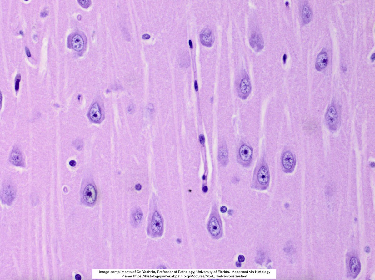 🧠 These cells in the brain always confused me because they are big, epithelioid and have prominent nucleoli.

🧠 They are NORMAL though.

🧠 What are they? 🤔 

#pathx #pathology #histology #neuropath #medx #usmle