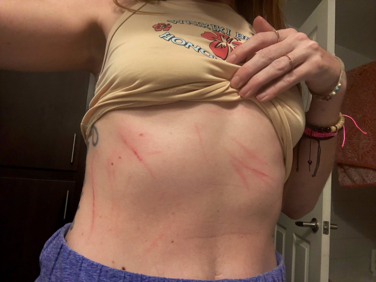 When I say I have the WORST luck I mean it 😂 In 24hrs I had a major leak in my roof (again), got attacked by my neighbors dog while walking mine and now someone hit my PARKED car. Currently being reported as a hit n run. I’m doooonnnee🥲