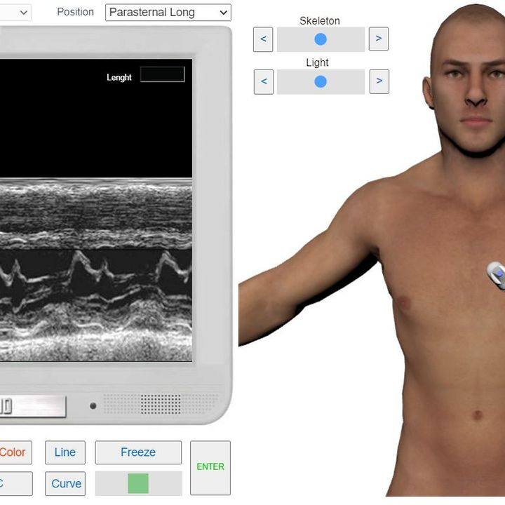 M-MODAL EXAMINATION OF THE MITRAL VALVE

Read more: myechocardiography.com/M_MV.html