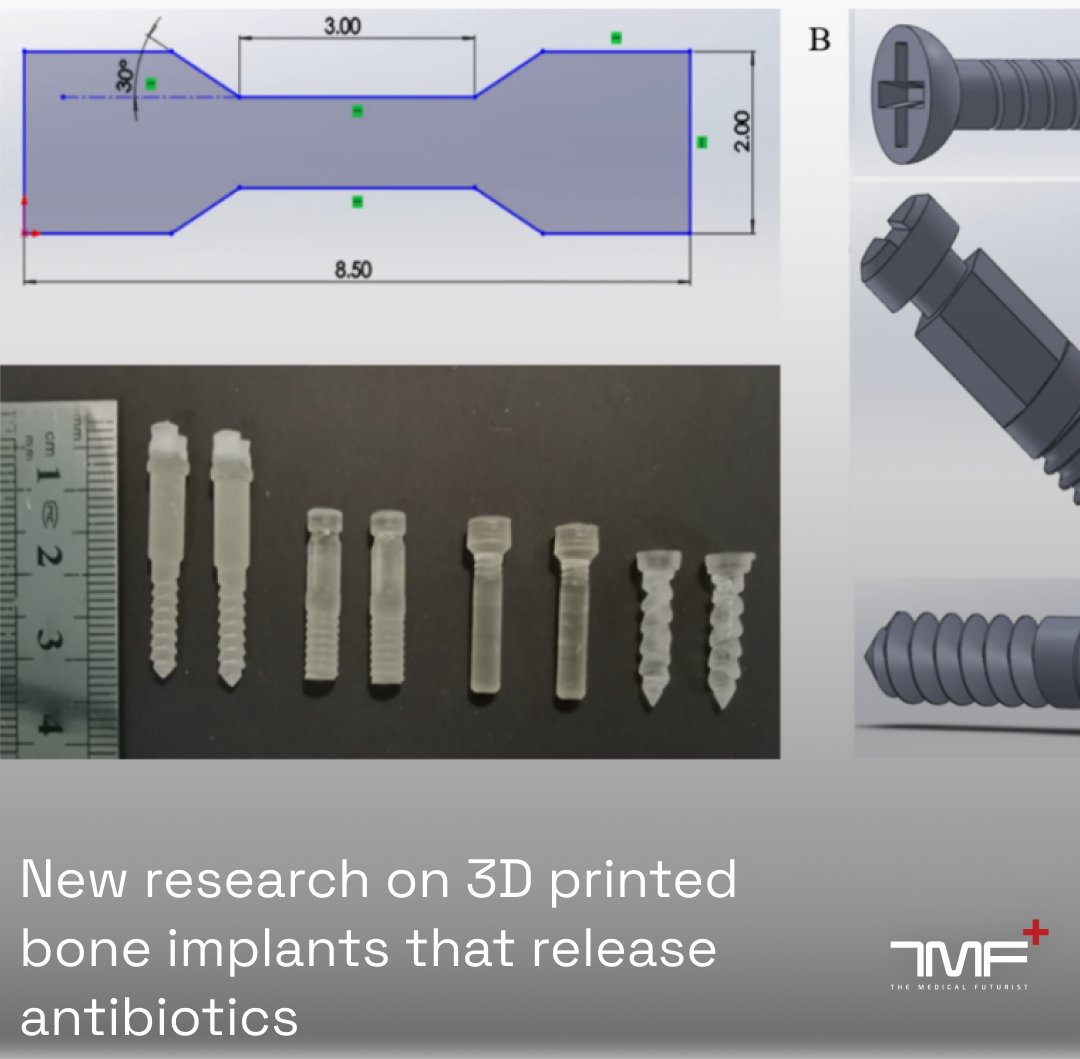 Berci's tweet image. Researchers have developed 3D printed bone fixation implants that combine structural support with targeted antibiotic delivery to prevent infections during surgery!
Great promise of using 3D printers at the patient's bedside, but:
"The implants haven’t been tested in living…
