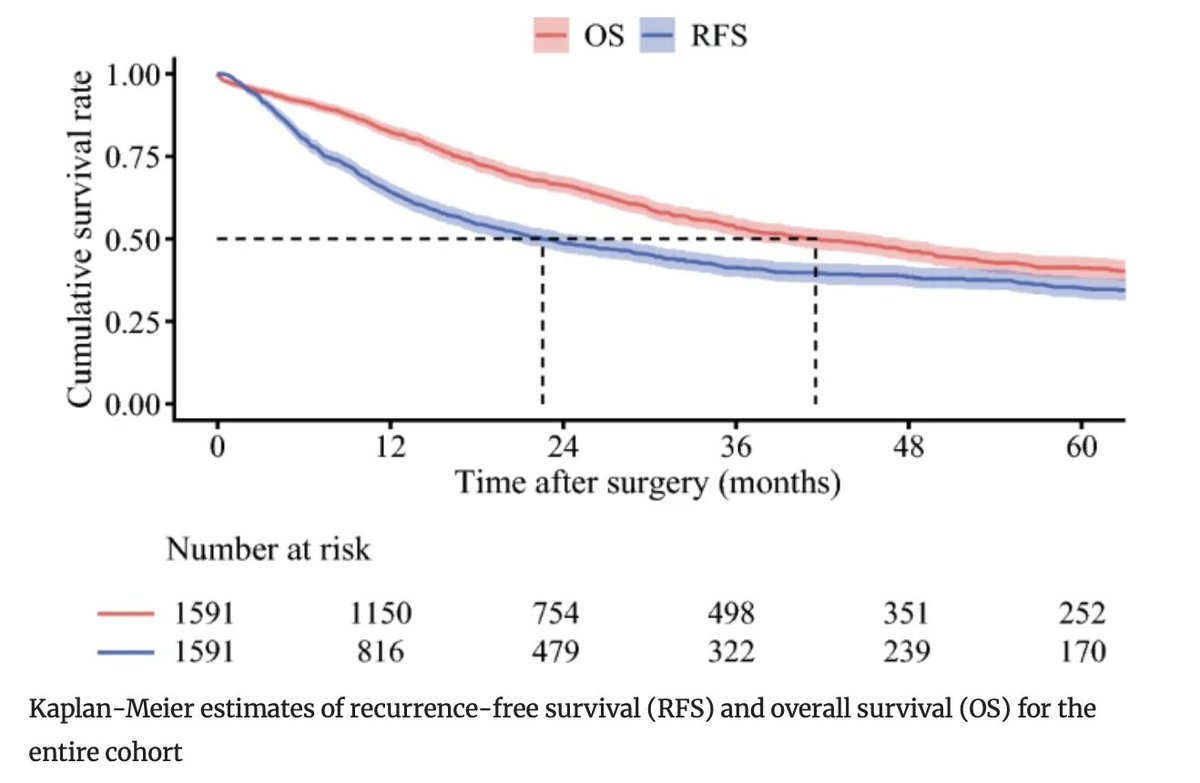 Annals of Surgical Oncology (@annsurgoncol) on Twitter photo July Issue: Recurrence-Free Survival as a Surrogate for Overall Survival Among Patients with Intrahepatic #Cholangiocarcinoma Following Upfront Surgery: An International Multi-institutional Analysis <a href="/Jun_Kawashima_x/">Jun Kawashima, MD</a> <a href="/timpawlik/">Timothy M. Pawlik</a>
rdcu.be/evTiV
<a href="/_BrainyMD_/">Micah J. Brainerd, M.D.</a>
<a href="/SyedAAhmad5/">Syed A. Ahmad</a> July Issue: Recurrence-Free Survival as a Surrogate for Overall Survival Among Patients with Intrahepatic #Cholangiocarcinoma Following Upfront Surgery: An International Multi-institutional Analysis <a href="/Jun_Kawashima_x/">Jun Kawashima, MD</a> <a href="/timpawlik/">Timothy M. Pawlik</a>
rdcu.be/evTiV
<a href="/_BrainyMD_/">Micah J. Brainerd, M.D.</a>
<a href="/SyedAAhmad5/">Syed A. Ahmad</a>