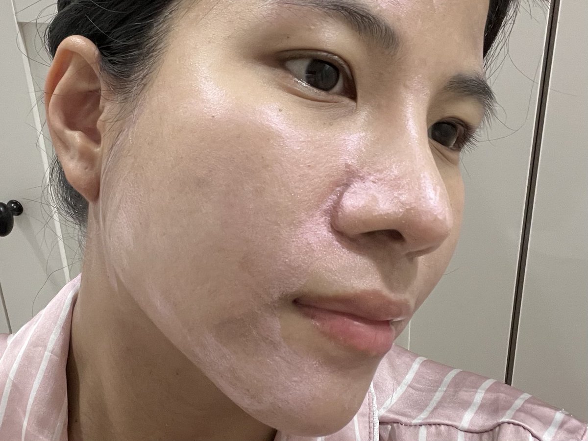 Sawarinni's tweet image. ใช้ มาส์ก ผลัดเซลล์ผิว ลอรีอัล แล้วผิวเนียนมากกกก เป็น พีลลิ่งมาส์กชมพู พวกรอยดำดูจางลงจริง ผิวดูสว่างขึ้นด้วย  แล้วใช้ง่ายมากก เขย่าขวด ทาให้ทั่วหน้า ทิ้งไว้ประมาณ 15 นาทีก็ล้างออกได้เลย ลูบหน้าแล้วผิวมันเนียน&amp;amp;ดูสดใสขึ้นตั้งแต่ครั้งแรกที่ใช้เลย ชอบมากกกกก