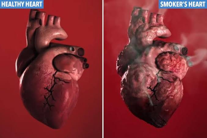 🚨 After reading this thread, you will never roll another blunt again.

This is how smoking silently ruins your body — organ by organ.

Thread 🧵