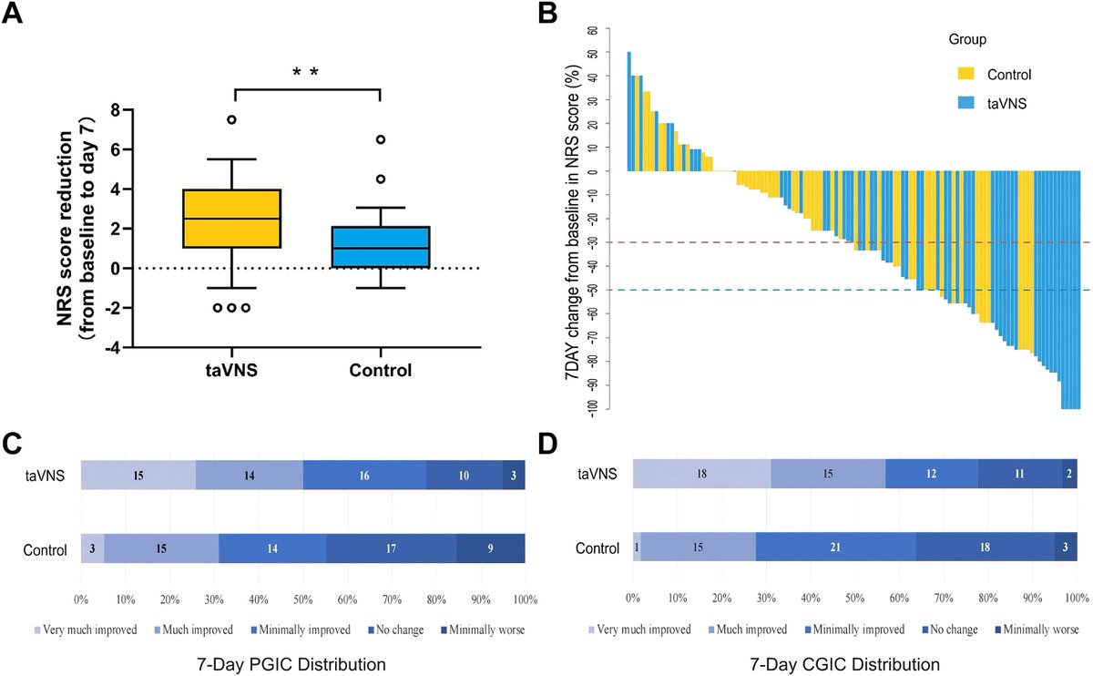 eClinicalMed's tweet image. Efficacy and safety of transcutaneous auricular vagus nerve stimulation plus pregabalin for radiotherapy-related neuropathic pain in head and neck #cancer
Showed significantly better pain relief in HNC with moderate-to-severe RRNP with no serious AEs
thelancet.com/journals/eclin…