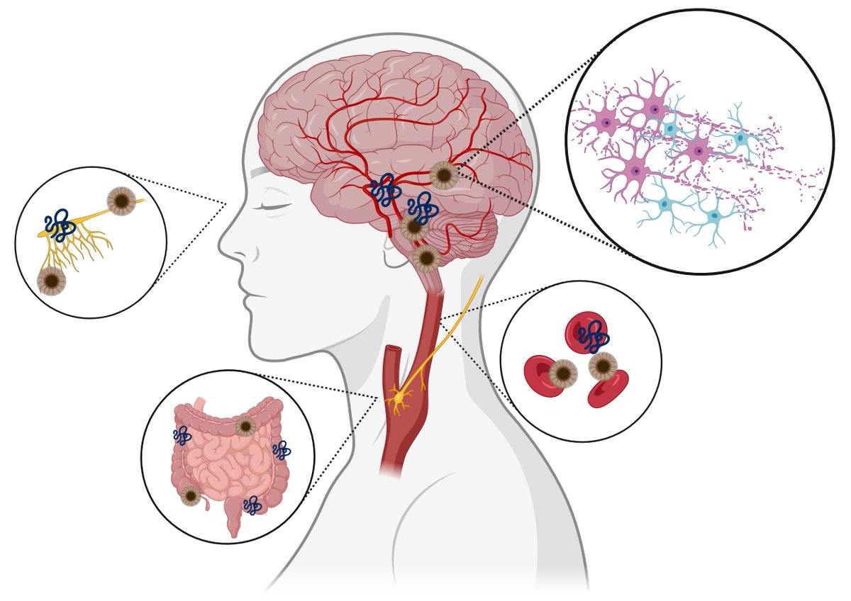 Landmark_IMR's tweet image. 🧠✨ New insights into systemic synucleinopathies!
While α-synuclein is known for its role in Parkinson’s & Lewy body dementia, emerging evidence shows it's also vital for hematopoietic & immune system function. Could its dual role explain broader disease impacts?
✒️ Author:…