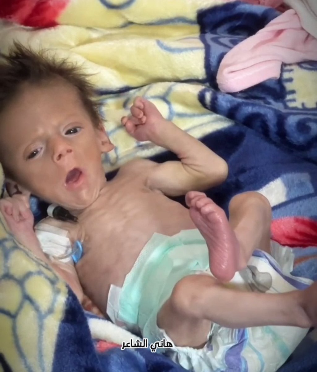 If you respond with 3 replys, you will help me a lot to make my post visible to everyone, even if a dot.
paypal.me/khatabweb?coun
GMF
gofundme.com/f/donate-to-he…