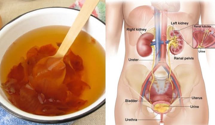 Support your bladder and prostate naturally with this grandfather’s time-tested drink!

If you frequently urinate or feel uncomfortable, try this herbal remedy:

✅1 tablespoon raw unsalted pumpkin seeds
✅1 tablespoon ground flaxseed
✅1 tablespoon dried or fresh nettle leaves