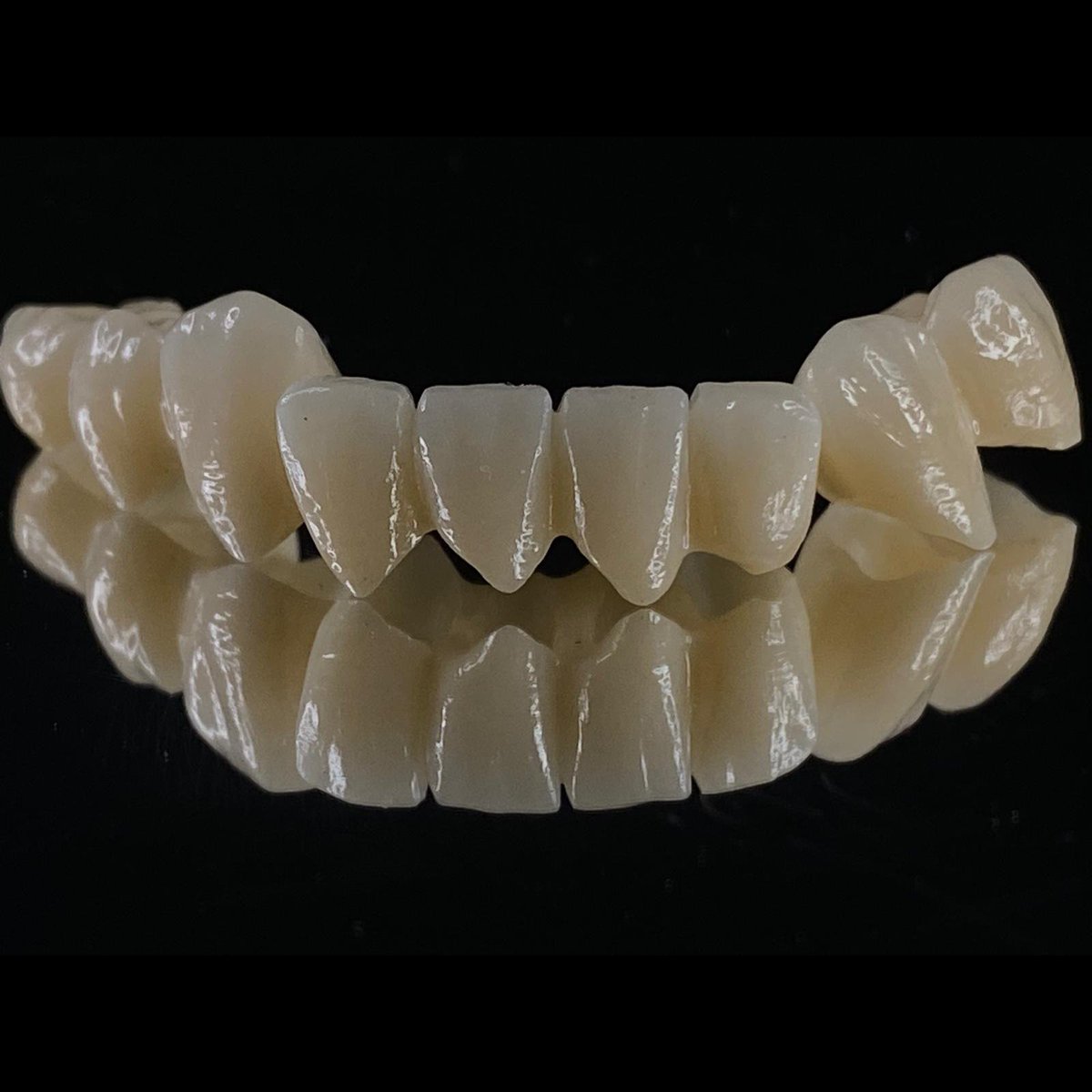 TheLabProtesis's tweet image. Empezamos la semana con estos tres puentes, 12 piezas de circonio monolítico que le cambiarán la vida a algún afortunado!