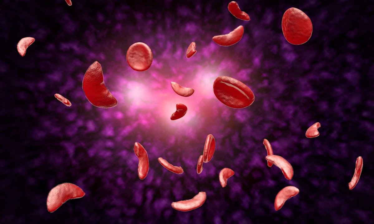 Drug Discovery World (@ddwjournal) on Twitter photo First patient receives gene therapy for haemophilia B in Germany
ddw-online.com/first-patient-…
#GeneTherapy First patient receives gene therapy for haemophilia B in Germany
ddw-online.com/first-patient-…
#GeneTherapy
