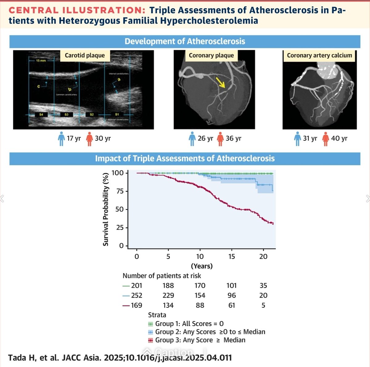 Triple Assessments of Atherosclerosis in Patients With Heterozygous Familial Hypercholesterolemia | JACC: Asia jacc.org/doi/10.1016/j.… 
<a href="/ClaraVinalsD/">Clara Viñals</a>