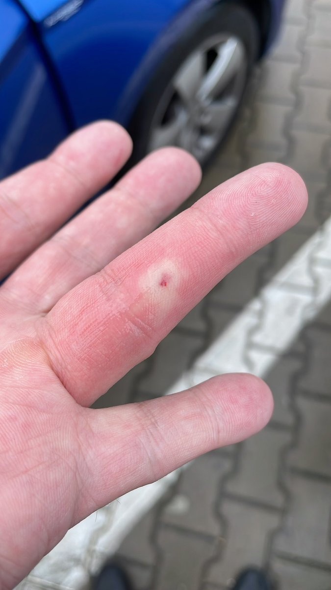 Butchi_9O5's tweet image. Dovolená v kurwa landu byla super, jediným negativním zážitkem bylo setkání s včelou, která se pokusila nelegálně migrovat do Česka schovaná v mé kapse, ovšem její životní pouť skončila v momentě, jsem sáhl do kapsy, abych zaplatil za naftu. RIP wczczszola a můj prst.