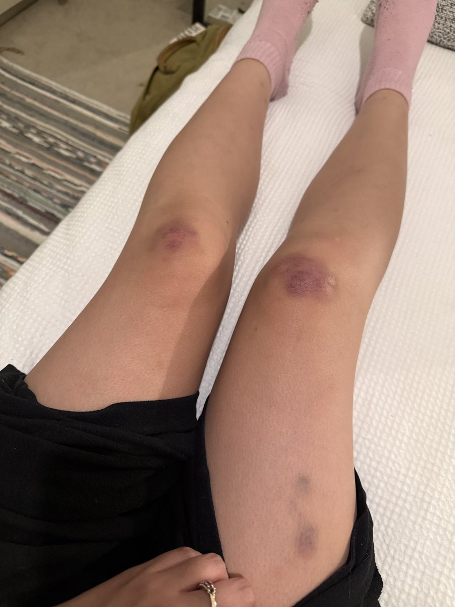 hard222soft's tweet image. u could never say i don’t go hard at barricade
