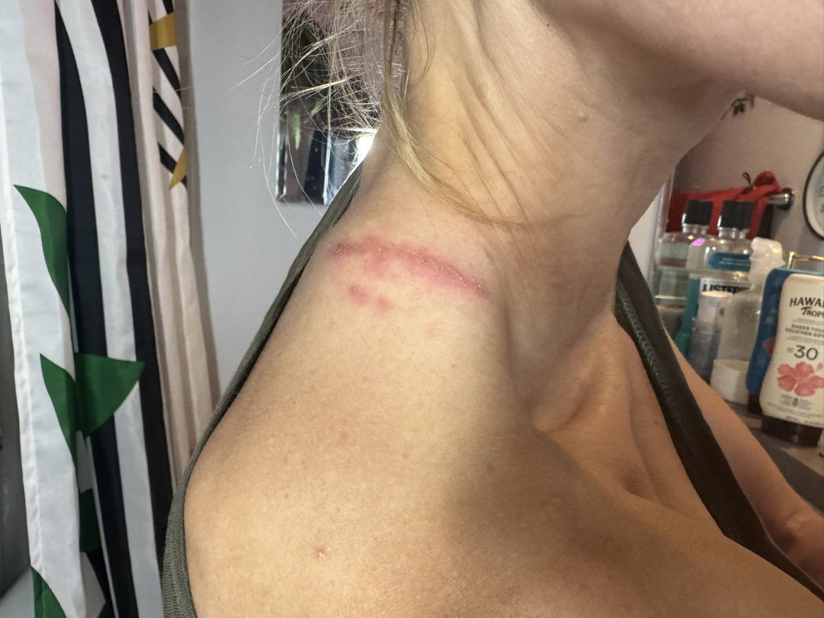 Kim Peccable (@kpeccable) on Twitter photo From my backpack, a 1-night hike with a faulty strap. Not pictured: blisters from worn hiking boots, raw hands & sad knee because of worn poles🥲….please send MEC gift cards to kimpeccable@hushmail.com 🙏🥹 need gear so bad 😭 & can’t work cause I need to hike 🙃 lol From my backpack, a 1-night hike with a faulty strap. Not pictured: blisters from worn hiking boots, raw hands & sad knee because of worn poles🥲….please send MEC gift cards to kimpeccable@hushmail.com 🙏🥹 need gear so bad 😭 & can’t work cause I need to hike 🙃 lol