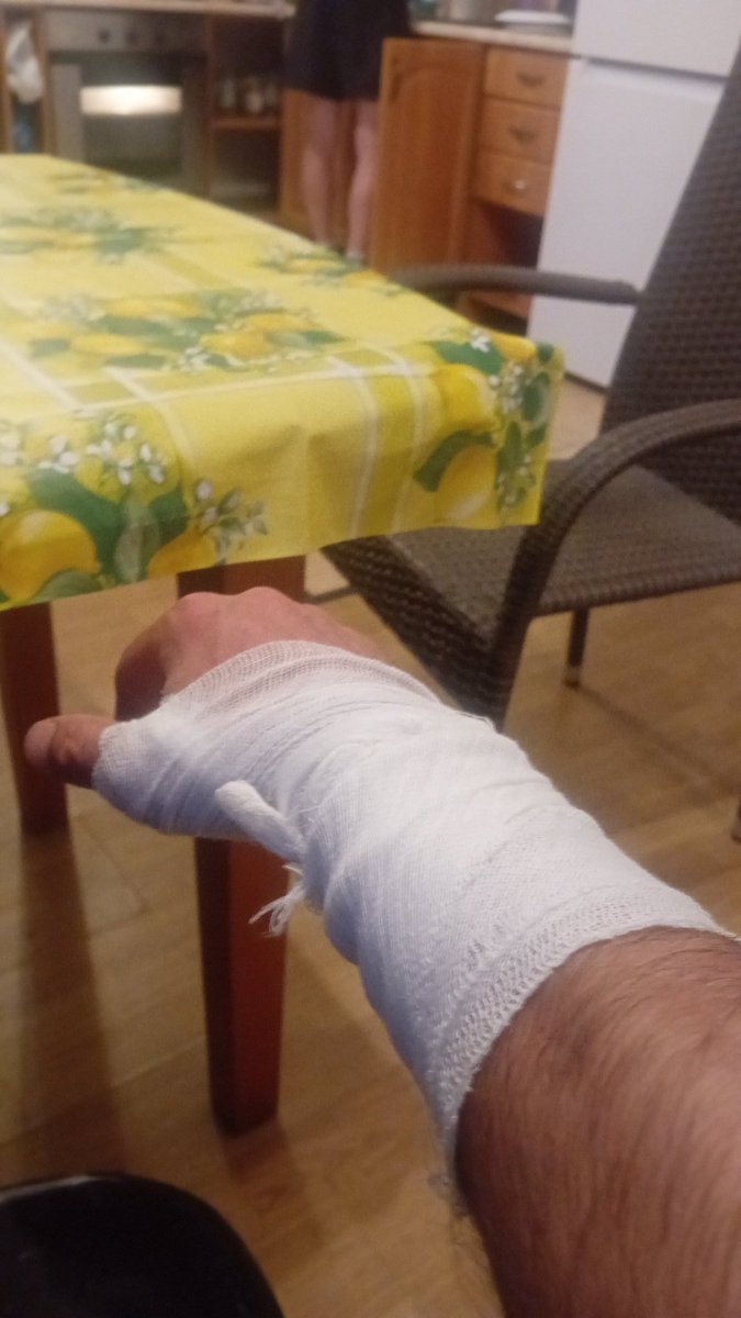 Начинается отпускание адреналина. Правую руку сделал. Начинает болеть правая сторона туловища от шеи и до пяток. 
С левой стороны- расстояние между большим пальцем и указательным.
Я не знаю, что будет с телом завтра.