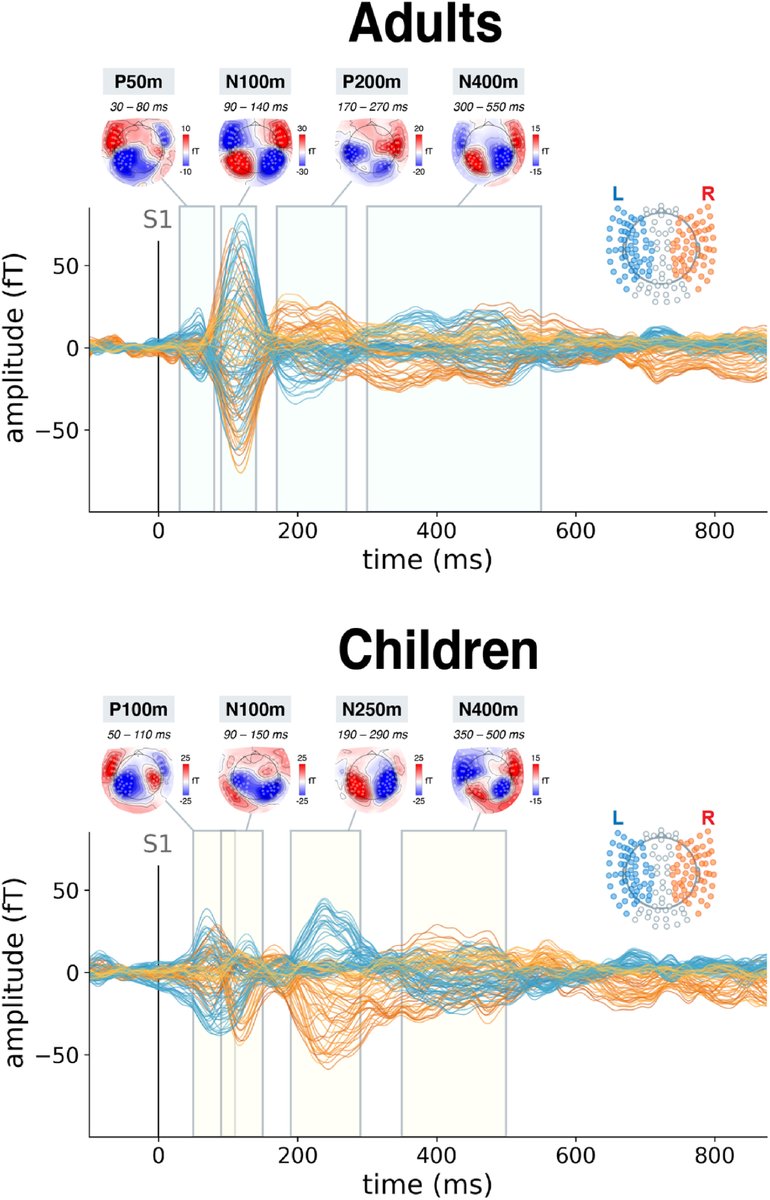 Excited to share that our work, "Changes in auditory evoked responses at different levels of linguistic processing in adults and school-age children: An MEG study," is now out in Neuropsychologia!
authors.elsevier.com/a/1lVCr_fKKpnmw