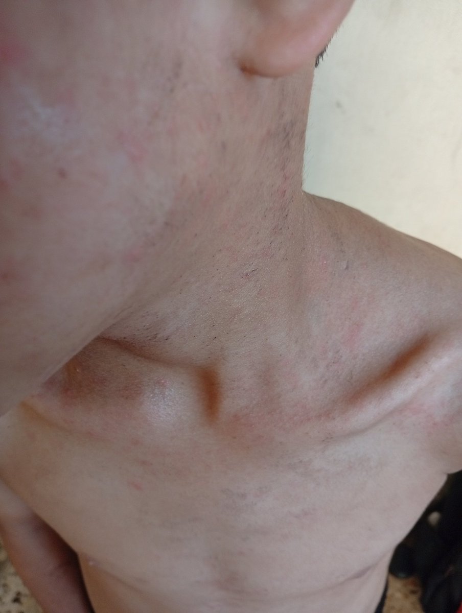 The disease has spread throughout Salah's child's body. Salah needs treatment and food before it's too late. Please help him as soon as possible....💔😭

If you’re scrolling, PLEASE leave a dot . it's just a dot
chuffed.org/project/127878