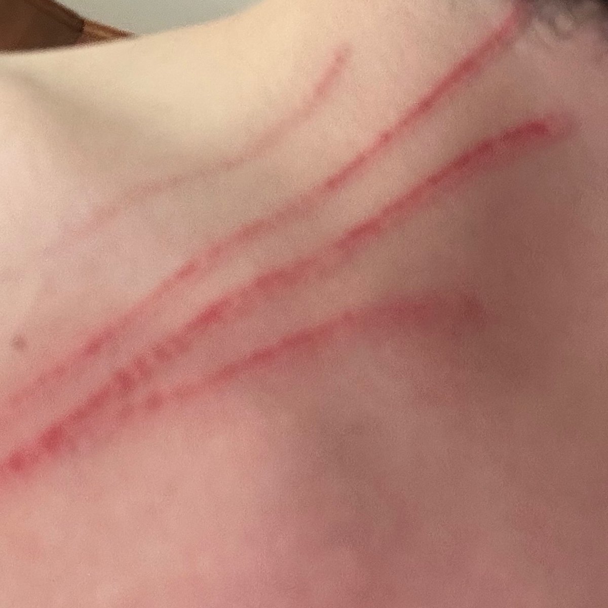 BasedschizoJ's tweet image. Ranger just stratched the ever living shit out of me when I tried to bring him into smol pool I ordered 😭