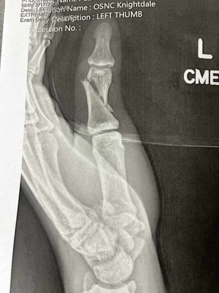 Glade to start the season 100  percent this year after a horrible hand injury and surgery,really thankful to all my coaches and trainers who all helped <a href="/EnloeHSFB/">Enloe Football</a>