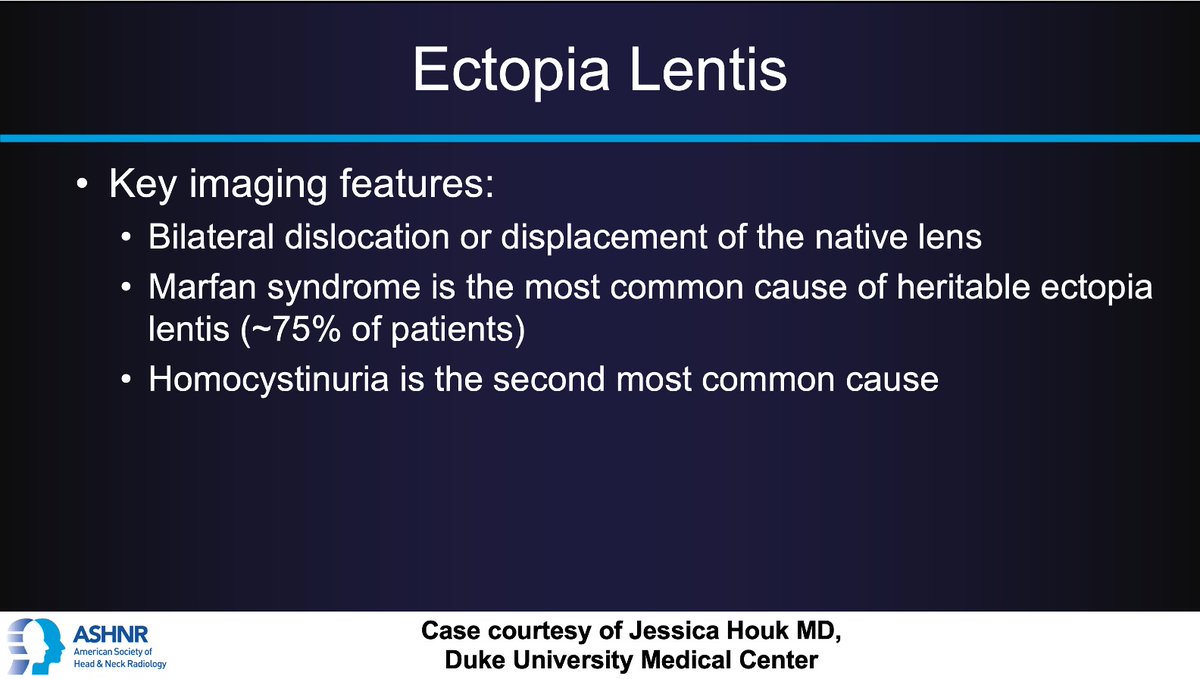 ASHNR (@ashnrsociety) on Twitter photo #ASHNRCOTW 307: ANSWER. Thx
<a href="/jhoukMD/">Jessica Houk</a> 4 case! #ASHNR25
<a href="/callyrobs/">Caroline Robson, MBChB</a> <a href="/DShatzkes/">Deborah Shatzkes</a> <a href="/CDP_Rad/">C Douglas Phillips ๐บ๐ธ</a> <a href="/rhwiggins/">Richard Wiggins</a>
<a href="/nakoontz/">Nicholas Koontz</a> <a href="/KRileyMD/">Kalen Riley</a> <a href="/CMGlastonbury/">Christine M Glastonbury, MD</a> <a href="/tabby_kennedy/">Tabby A. Kennedy, MD</a> <a href="/PhilipRChapman1/">Philip R. Chapman, MD</a> <a href="/cmtomblinson/">Courtney Tomblinson, MD</a>
<a href="/amyfjuliano/">Amy Juliano</a> <a href="/bpoliceni/">Bruno Policeni</a> <a href="/MohitTCCNeuro/">Mohit Agarwal</a> <a href="/AshokSrini15/">Ashok Srinivasan</a> <a href="/KatieTraylorDO/">Katie S. Traylor MS, DO, DABR</a> <a href="/CynXinWu/">Cynthia Xin Wu</a> #ASHNRCOTW 307: ANSWER. Thx
<a href="/jhoukMD/">Jessica Houk</a> 4 case! #ASHNR25
<a href="/callyrobs/">Caroline Robson, MBChB</a> <a href="/DShatzkes/">Deborah Shatzkes</a> <a href="/CDP_Rad/">C Douglas Phillips ๐บ๐ธ</a> <a href="/rhwiggins/">Richard Wiggins</a>
<a href="/nakoontz/">Nicholas Koontz</a> <a href="/KRileyMD/">Kalen Riley</a> <a href="/CMGlastonbury/">Christine M Glastonbury, MD</a> <a href="/tabby_kennedy/">Tabby A. Kennedy, MD</a> <a href="/PhilipRChapman1/">Philip R. Chapman, MD</a> <a href="/cmtomblinson/">Courtney Tomblinson, MD</a>
<a href="/amyfjuliano/">Amy Juliano</a> <a href="/bpoliceni/">Bruno Policeni</a> <a href="/MohitTCCNeuro/">Mohit Agarwal</a> <a href="/AshokSrini15/">Ashok Srinivasan</a> <a href="/KatieTraylorDO/">Katie S. Traylor MS, DO, DABR</a> <a href="/CynXinWu/">Cynthia Xin Wu</a>