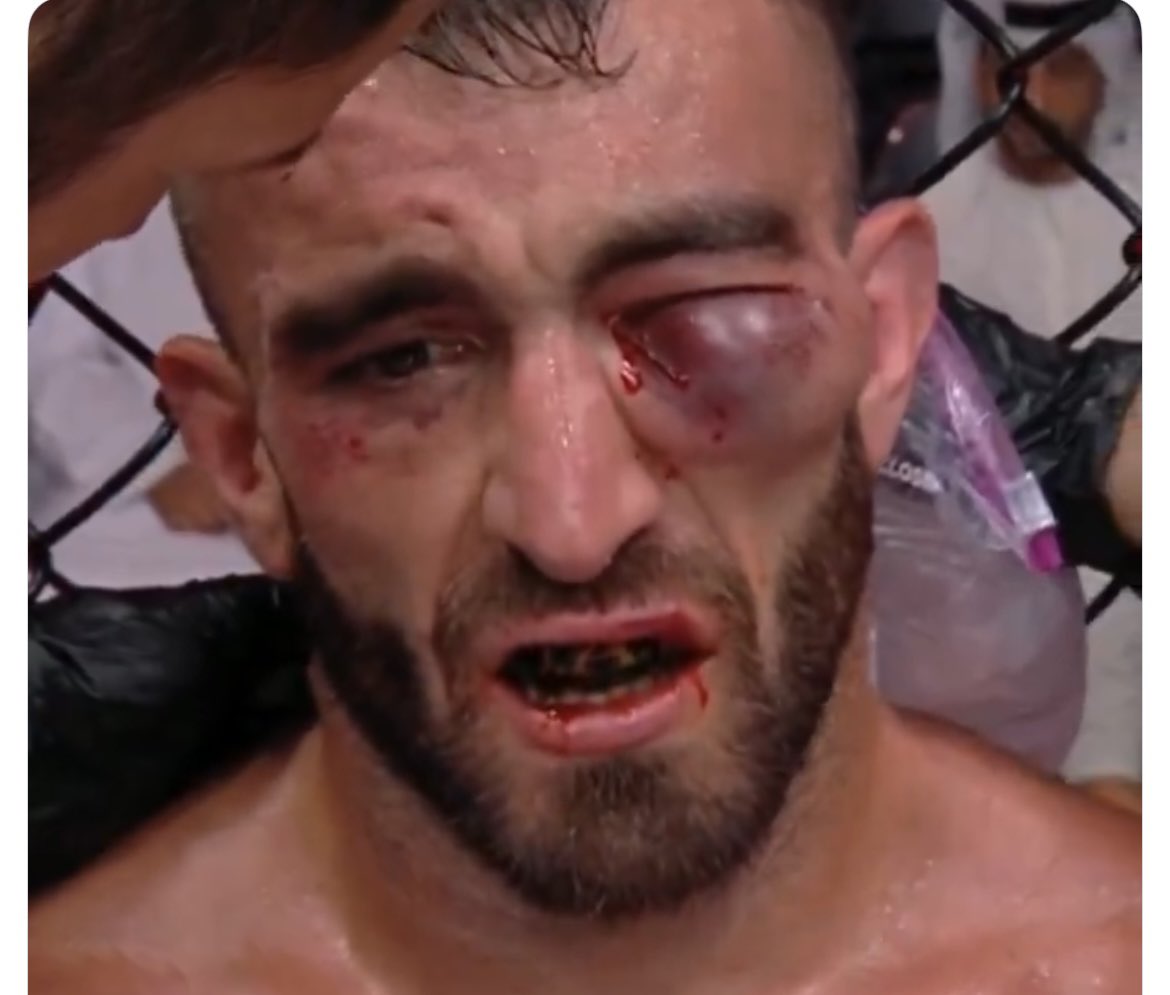 jzzza's tweet image. Yeah, they might have taken a little too long to stop this fight. Six fucken knockdowns?Really?