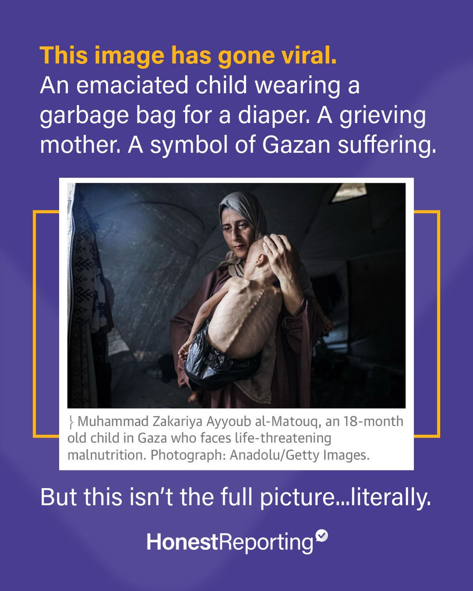 You’ve seen this photo. It’s real. Not AI. Not from Yemen or Syria. It’s a child in Gaza.

But this isn't the full picture. Literally.🧵