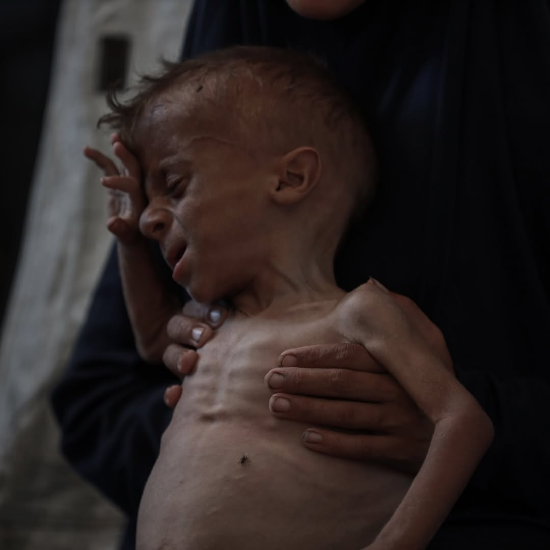 GazaNewsPlus's tweet image. 🔴🔴🇵🇸 [ FLASH INFO ] Bureau d&apos;information du gouvernement à Gaza :

▪️&quot;La famine meurtrière imposée par l&apos;occupation a conduit jusqu&apos;à présent à la mort de 127 Palestiniens, dont 85 enfants.&quot;

▪️&quot;L&apos;occupation exerce une pression humanitaire ignoble sur 2,4 millions de personnes…