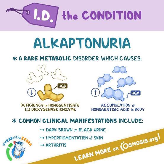 <a href="/IhabFathiSulima/">Dr Ihab Suliman</a> Alkaptonuria