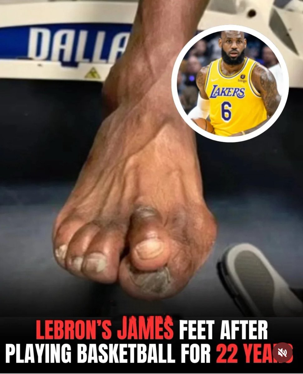 That’s not a foot… that’s a Hall of Pain.