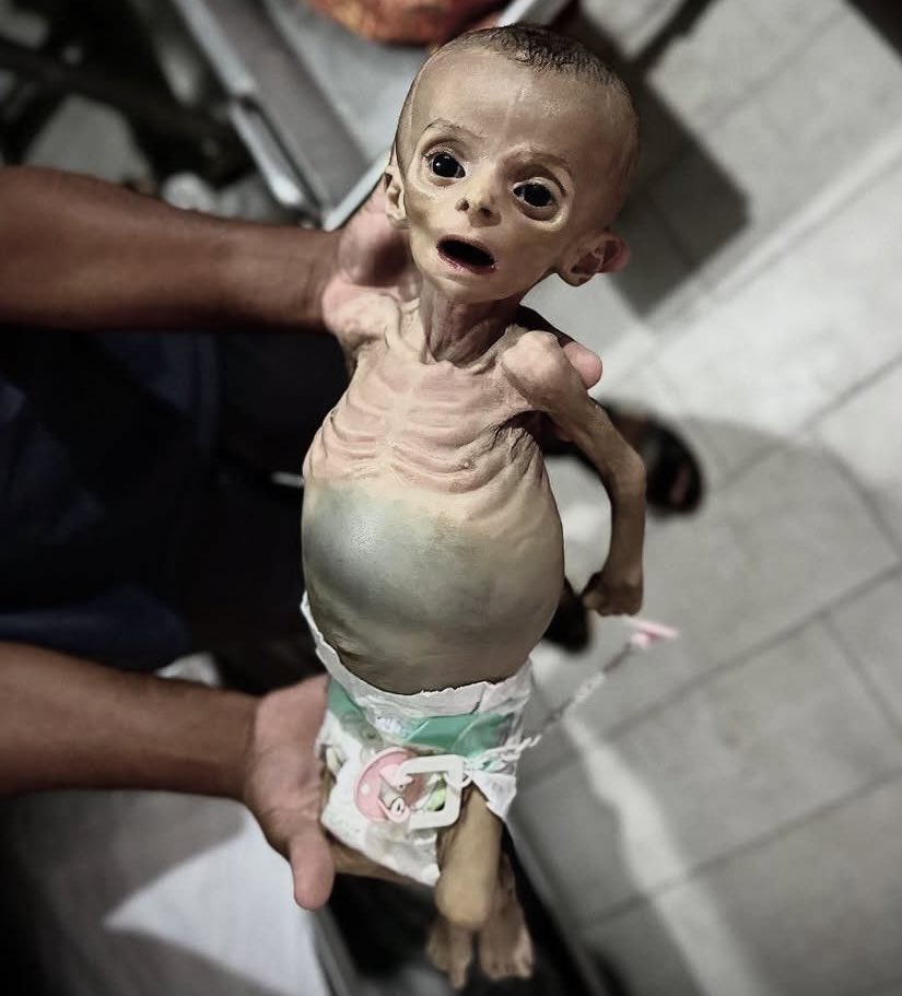 If you’re scrolling, PLEASE leave a dot.

Pray for this little angel 💔🇵🇸