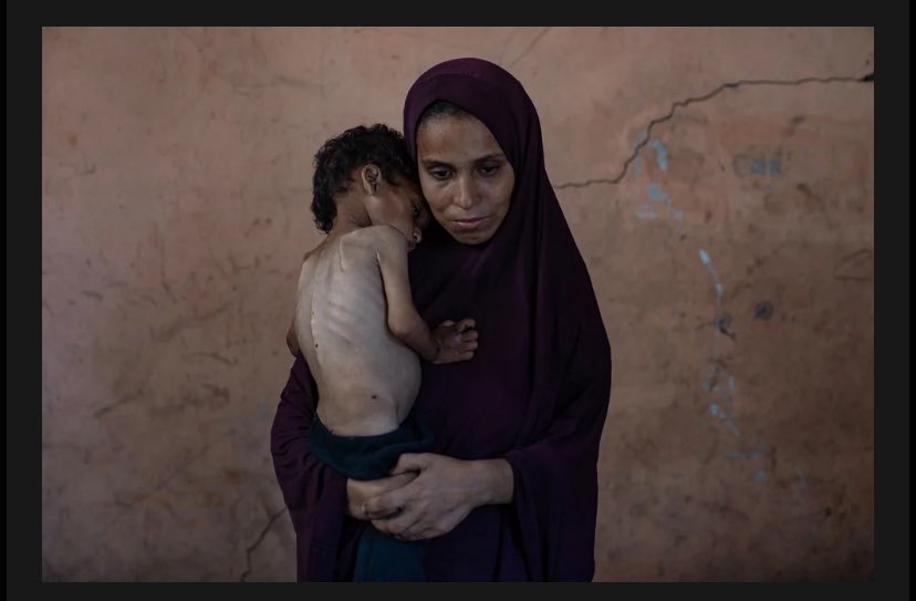 #Gaza is deliberate starvation and war crimes amounting to genocide. Children are dying from hunger, civilians are slaughtered, and hospitals turned to rubble. The West U.K., US etc armed and shielded Israel while it carried out #warcrimes. We won’t forget - history won’t forgive