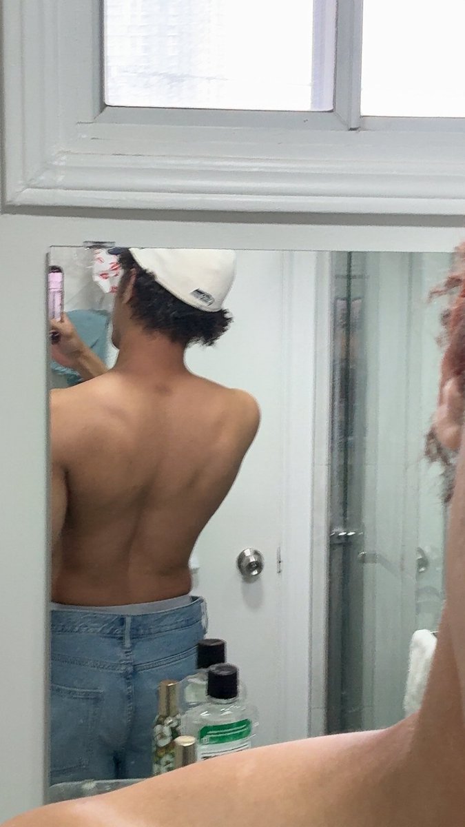 301APT's tweet image. Does anyone else get this perma-bruise from the squat bar