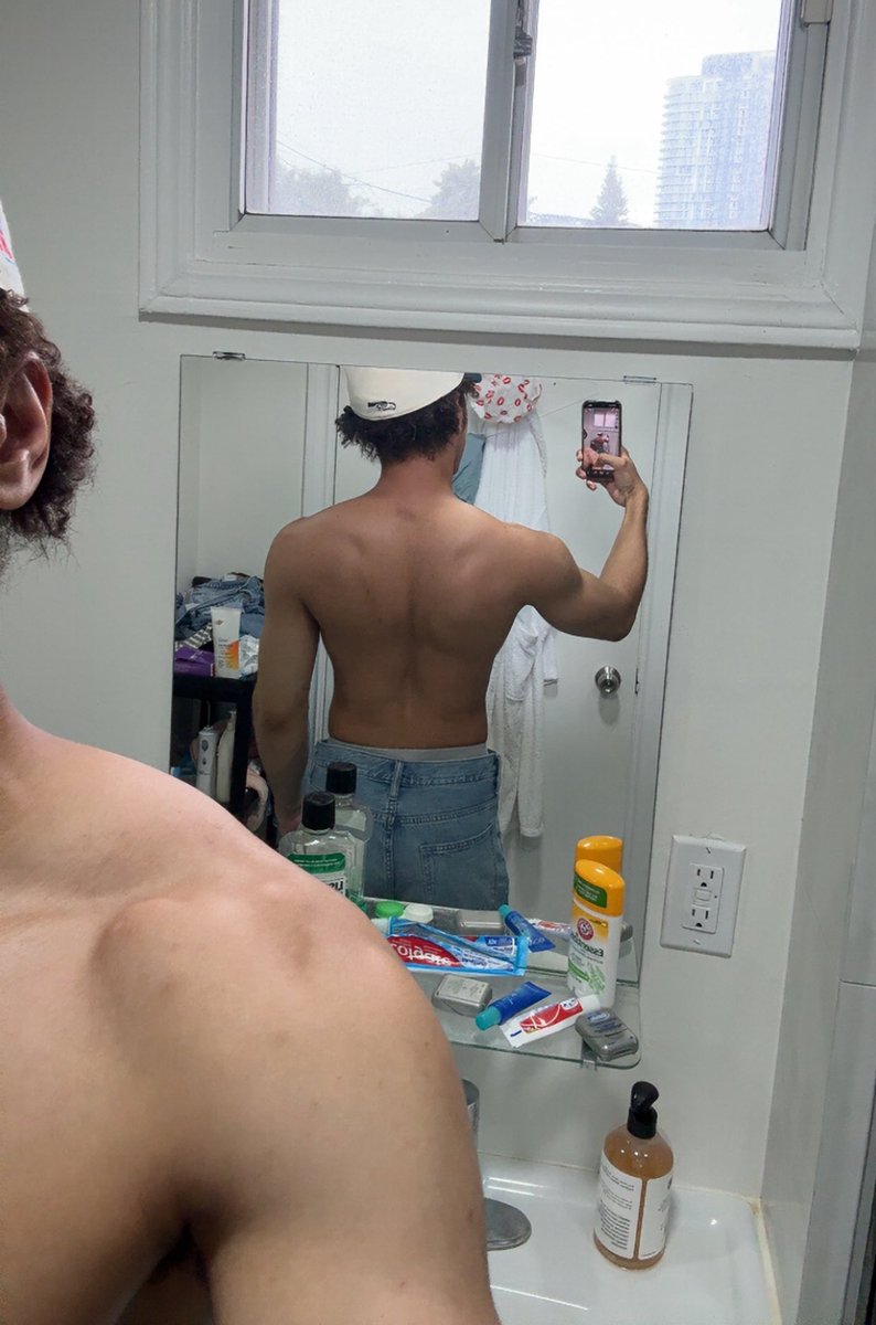 301APT's tweet image. Does anyone else get this perma-bruise from the squat bar