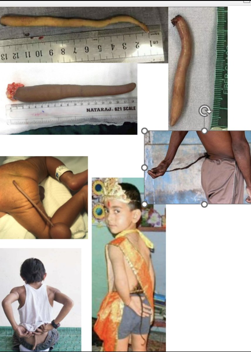 MeasureOfGod's tweet image. The AIPAC ships in ape varieties to all European countries, like the wicked witch in a narcissistic rage. The only Replacement Out of Africa that ever happened is the one they've been working on since WWII. It's impossible when Europeans &amp;amp; non-Europeans don't share DNA.