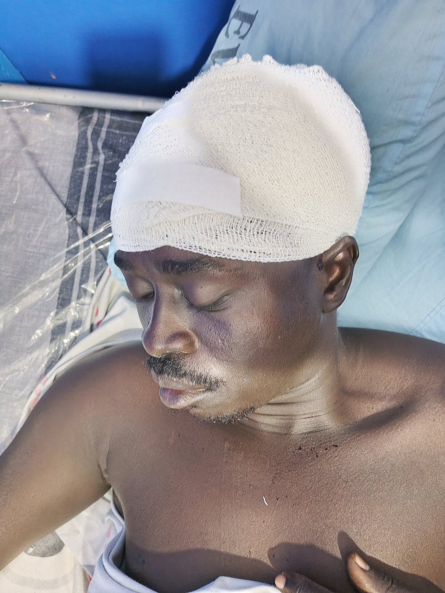 AsiteDeking's tweet image. Put me in prayers, thief&apos;s attacked me on my way Yesternight. Having serious head injuries.