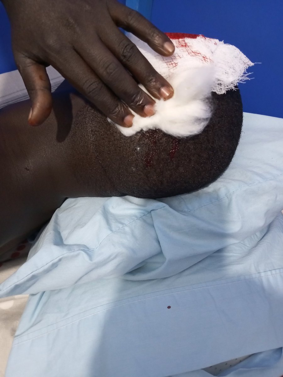AsiteDeking's tweet image. Put me in prayers, thief&apos;s attacked me on my way Yesternight. Having serious head injuries.