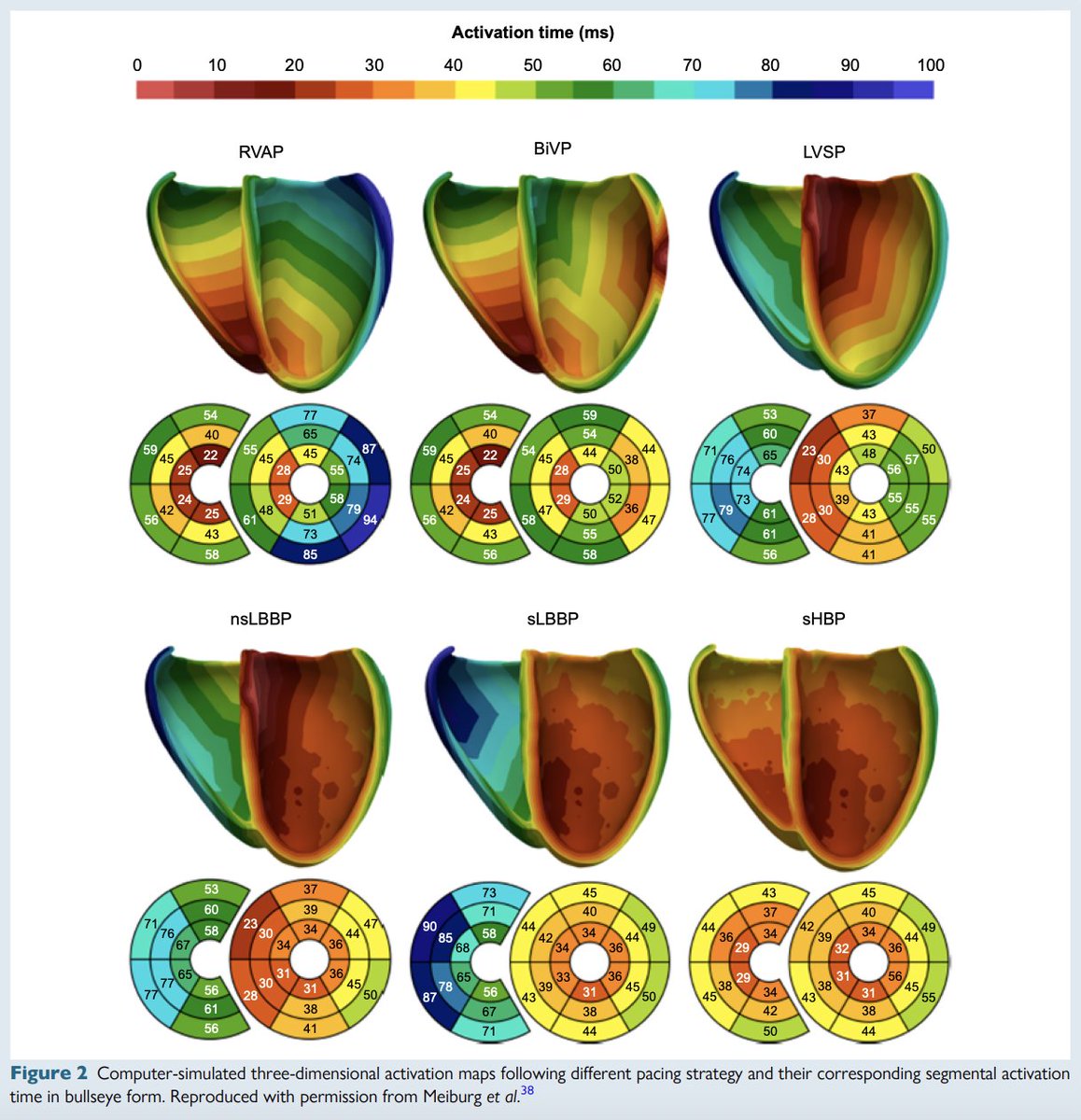 pzhong2016's tweet image. Activation maps following different pacing strategy