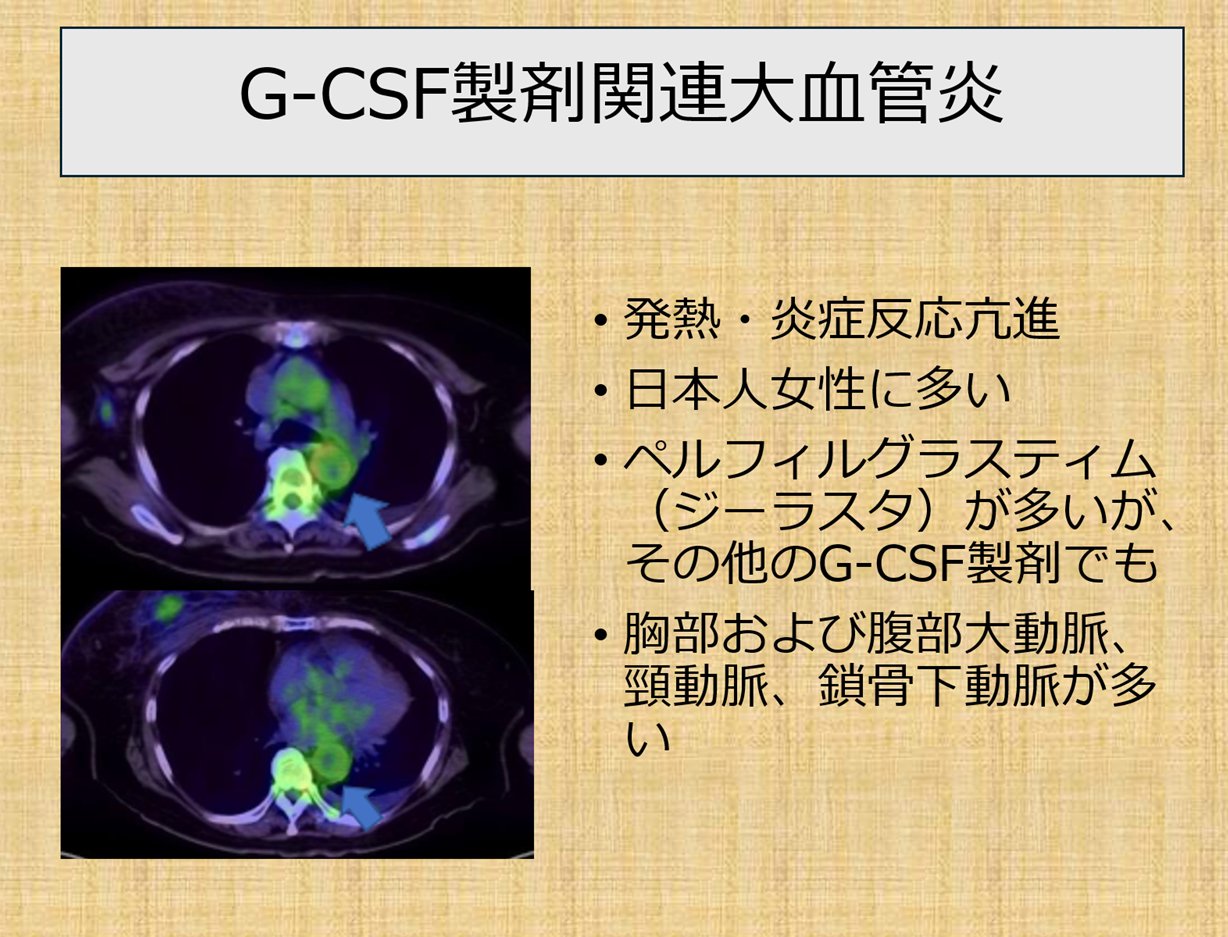金やん on X: 