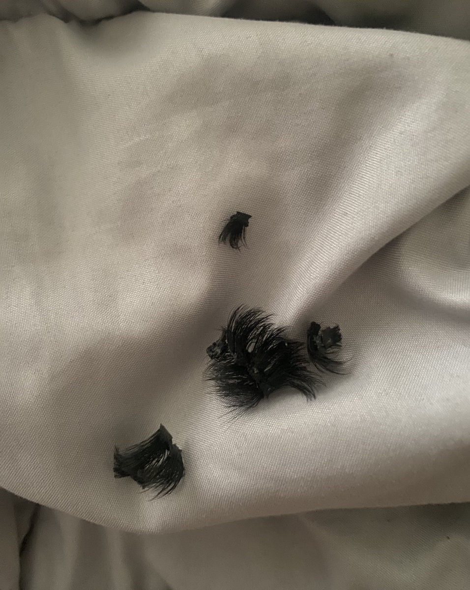 MsMiriti's tweet image. i love being a baddie until the itching