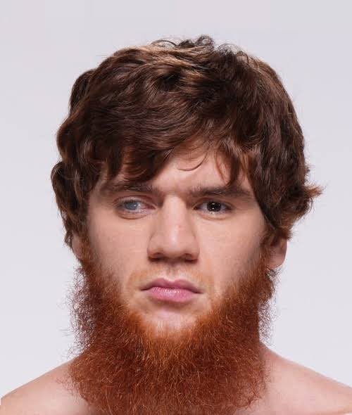 AlaskaFromPigmo's tweet image. Imagine him with 2 eyes…