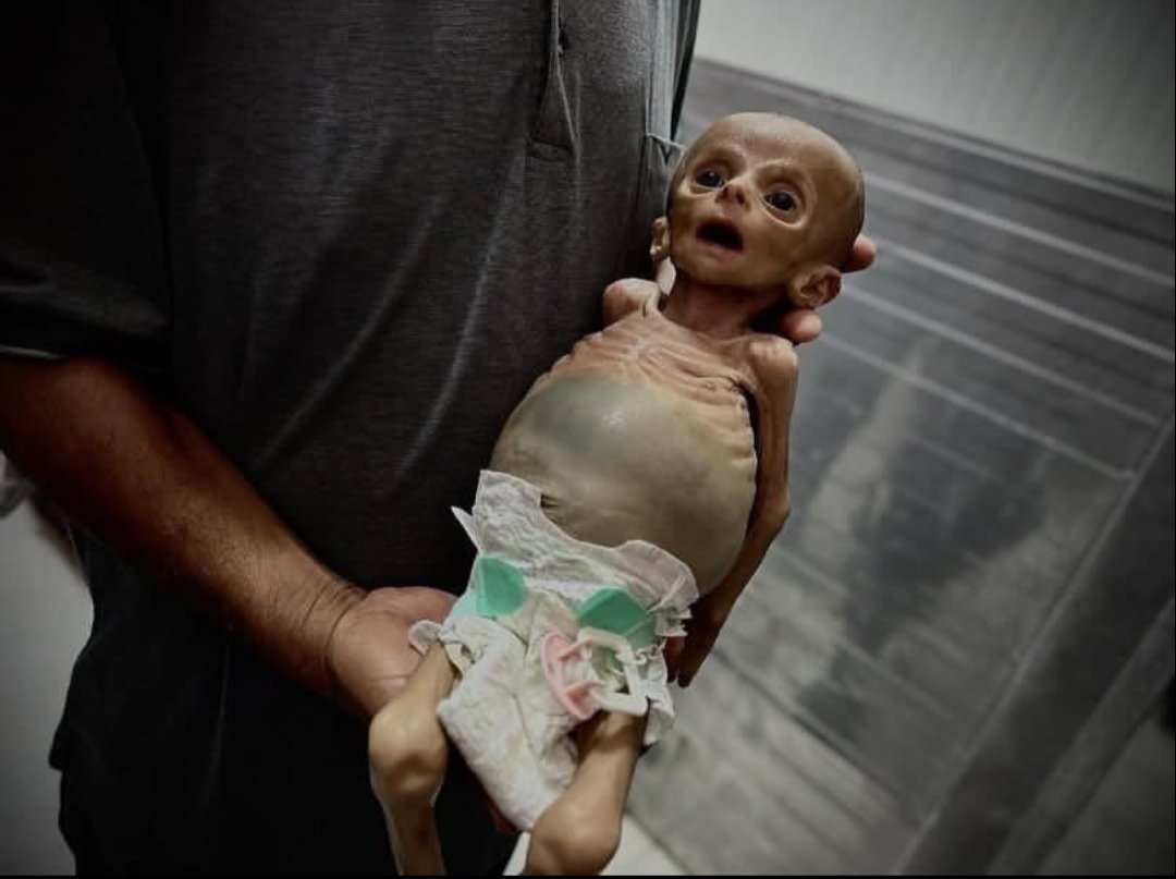 TrueTruth64's tweet image. Zainab Abu Hulaib, starved to death by Israel. 🥲 while world watches. 😔.

#ShieldsDaniels #EpsteinTrumpFiles #HelpTürkiye #IsraelTerroristState
