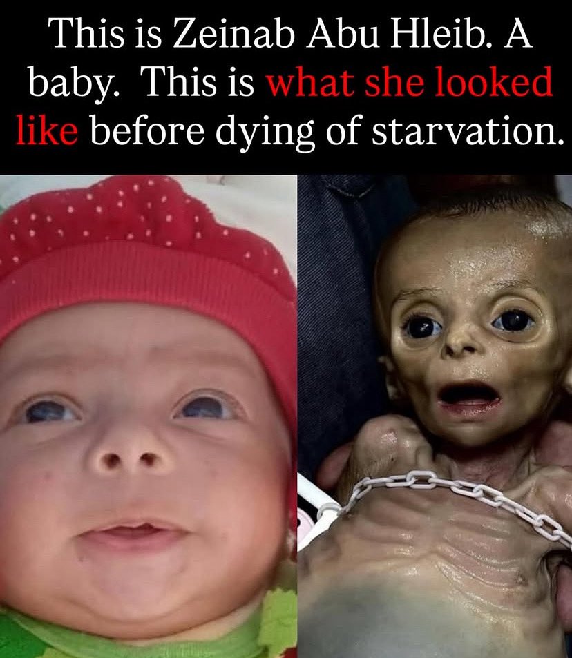 RajeshHolmen's tweet image. Zainab Abu Hulaib døde for nylig af alvorlig underernæring i #Gaza. Hun nåede kun at blive 6 måneder gammel 💔

Dette er resultatet af Israels systematiske blokade af nødhjælp, hvor sult bruges som våben mod en indespærret og udsultet civilbefolkning.

Hvor længe vil verden…