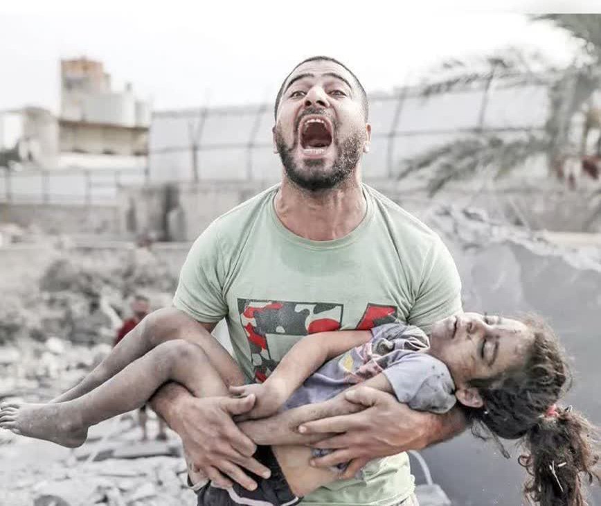 GazaReality's tweet image. A man whose daughter was killed in #Gaza
Do you still care about what's happening in Gaza?
Comment with a dot 💔