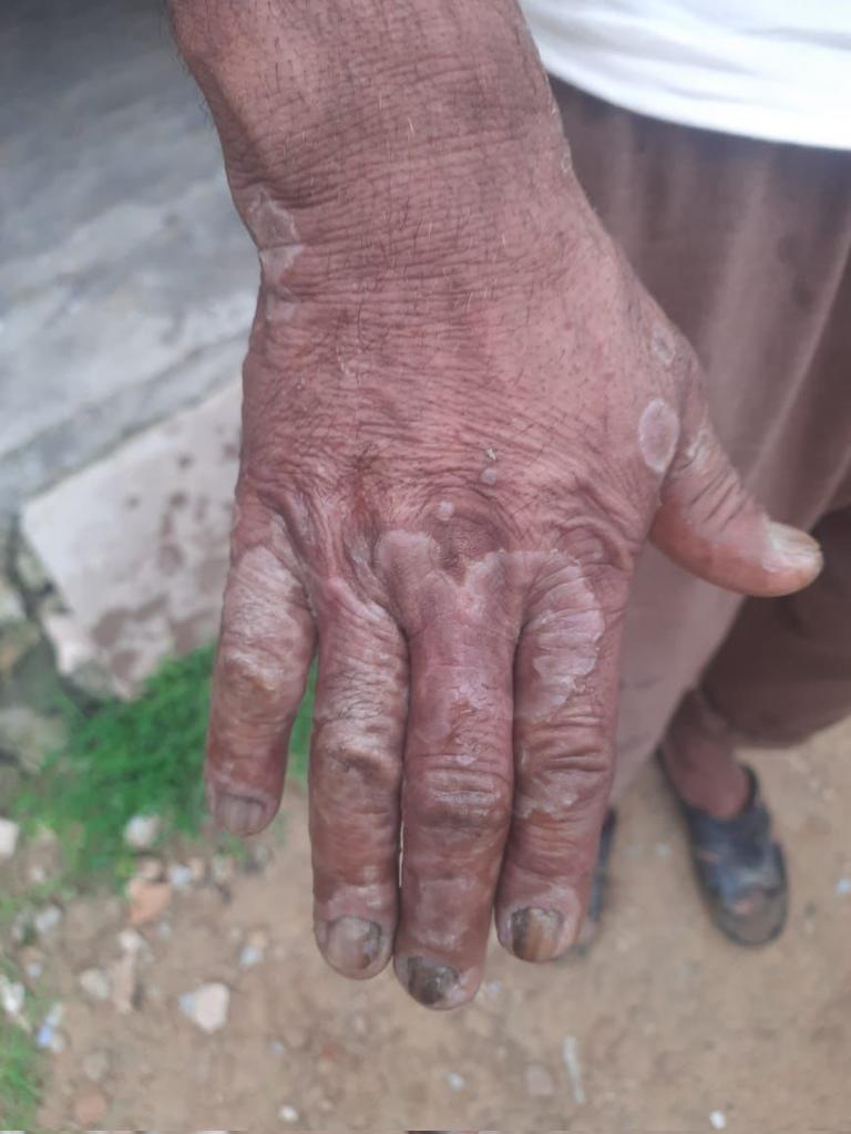 Diagnosis...??
<a href="/Janetbirdope/">Janet Pope</a>